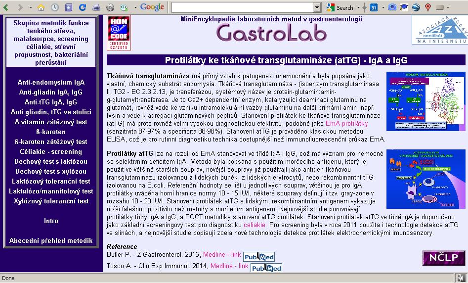 http://www1.lf1.cuni.cz/~kocna/glab/glency1.htm cz/~ /~kocna /glency1.
