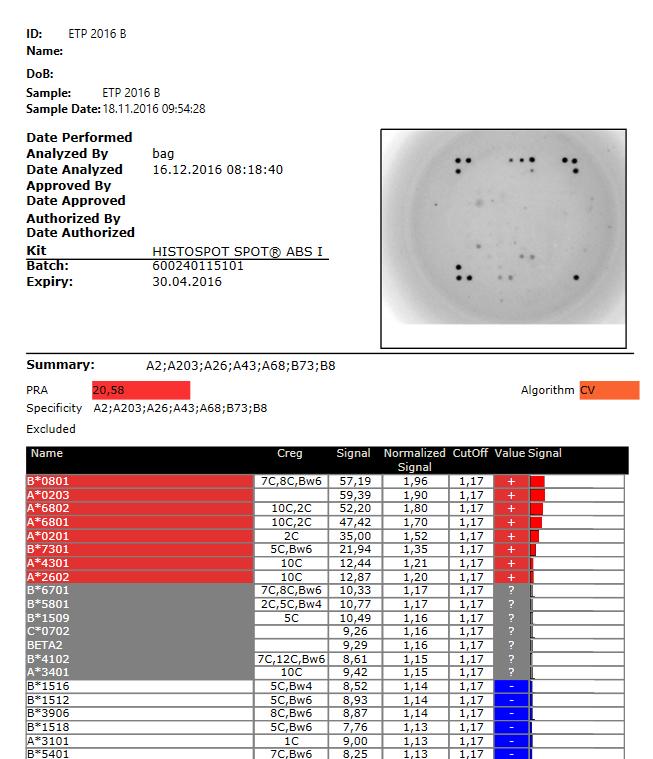 Sample. Tento typ zprávy obsahuje stránku s obecnými informacemi o vzorku a stránku pro každý test provedený s tímto vzorkem. 14.