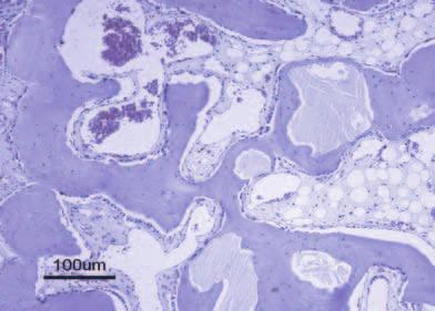 MKT-CAT0515CZ OsteoBiol Tecnoss s.r.l. je inovativní celosvětově působící společnost, která vyvíjí, vyrábí a dokumentuje xenogenní biomateriály té nejvyšší kvality značek Tecnoss a OsteoBiol.
