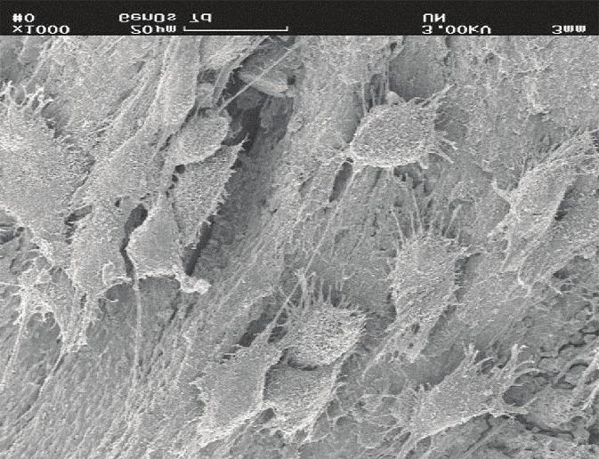 Mikrofotografie granule produktu OsteoBiol Gen-Os kolonizované osteoblasty z buněčné struktury