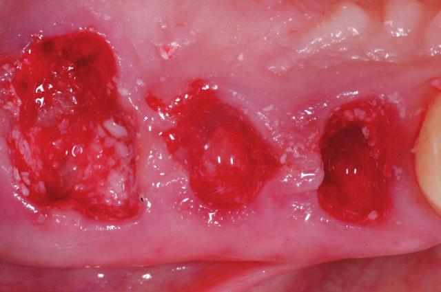 produktu OsteoBiol mp3 Zdroj: Laskavě zapůjčil dr.