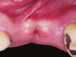 resorption time About 15 days Inovace Packaging 20x20 mm, 25x25 mm Obr. 7 Obr.