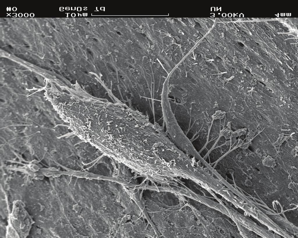 VYSOKÁ BIOKOMPATIBILITA Chemická skladba každé dvoufázové granule OsteoBiol, její ideální propustnost a