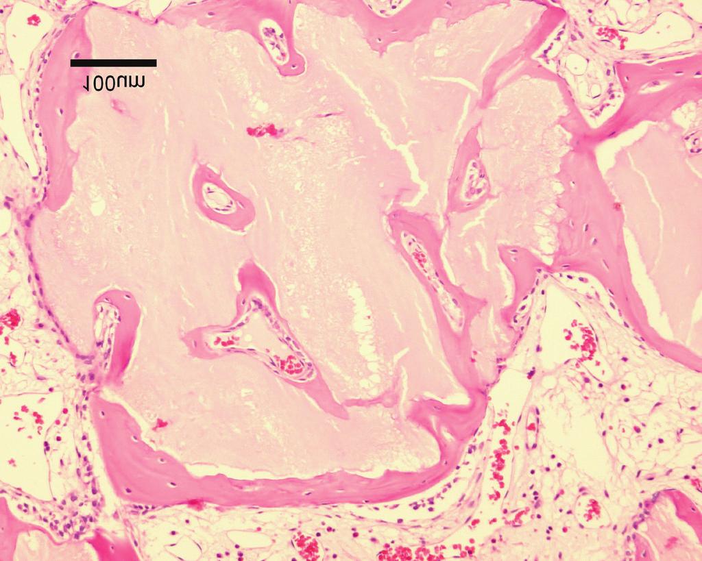 Část biopsie zachycující nově zformovanou kost uvnitř a okolo částice produktu OsteoBiol mp3 čtyři týdny po