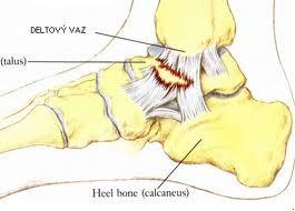 Traumatologie natažení,ruptury,výrony,zhmoždění