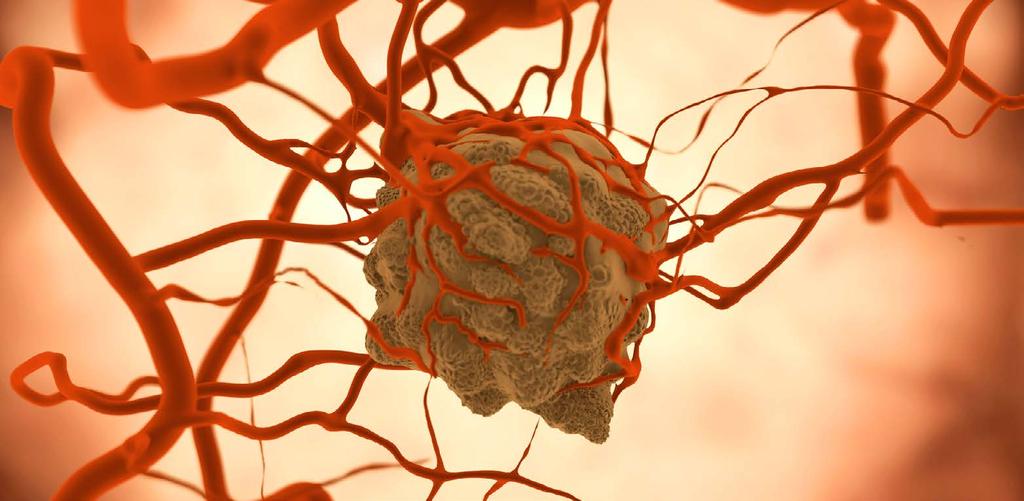 Síť ERN pro syndromy zvýšeného genetického rizika vzniku nádorového onemocnění (ERN GENTURIS) Syndromy zvýšeného genetického rizika vzniku nádorového onemocnění jsou onemocnění, u nichž zděděné