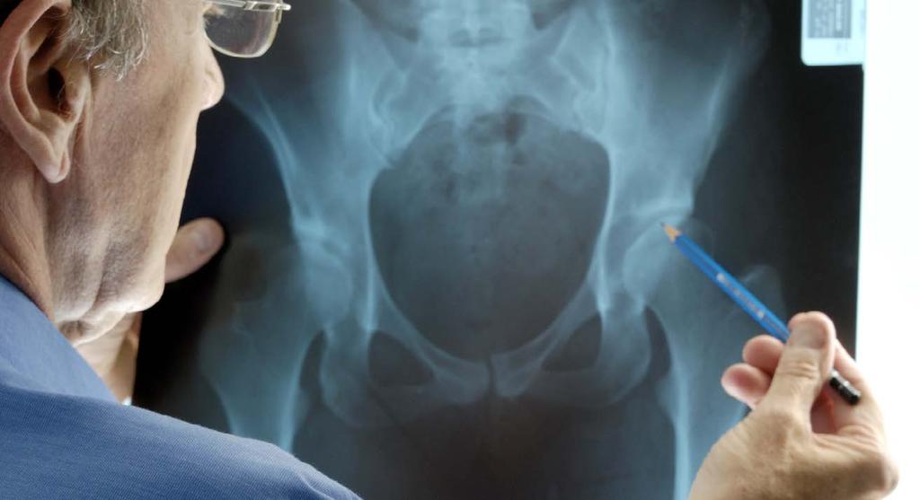 Síť ERN pro onemocnění pojivových tkání a muskuloskeletální onemocnění (ERN ReCONNET) 30 Mezi vzácná onemocnění pojivových tkání a muskuloskeletální onemocnění (rctds) patří velké množství onemocnění