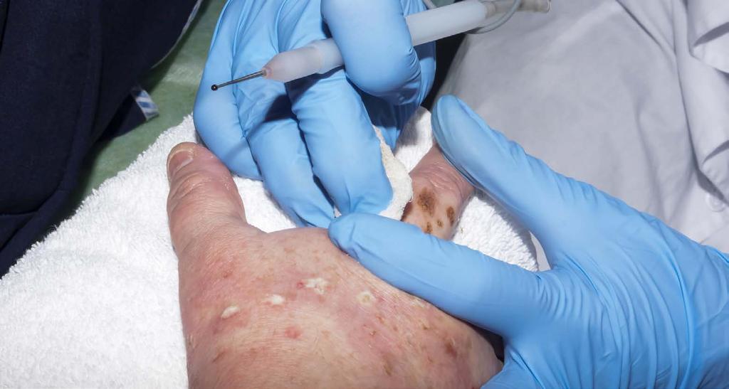 Síť ERN pro kožní onemocnění (ERN Skin) 34 Mnoho kožních onemocnění má na pacienty vážný dopad a lze je spojit s rizikem rakoviny.