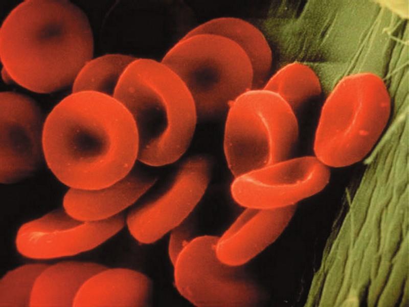 2. LIPOPROTEINY - součást buněčných mebrán, cytoplasmy buněk, krevní plasmy a vaječného žloutku - nejprostudovanější : PLASMOVÉ