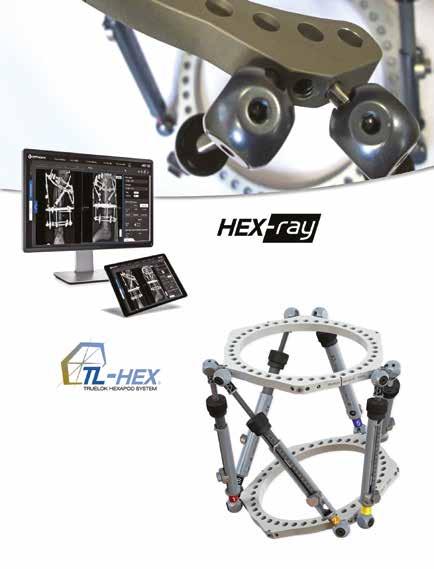 www.orthofix.com TL-HEX software ver. 2.2 Modul pro přímé plánování ze snímků.
