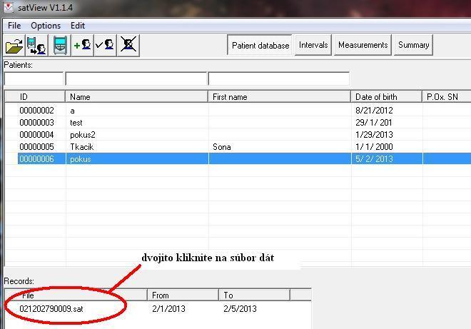 12. Synchronizujte čas PC s časovým údajom na oximetri stlačením TRANSFER PC TIME. 13.