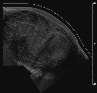 Závěry Výhody panoramatického UZ : kvalitnější dokumentace - více informací na jednom obraze - lepší korelace s CT či MR lepší anatomická orientace lepší