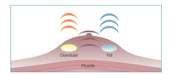 Digital broadband beamforming Co nejširší