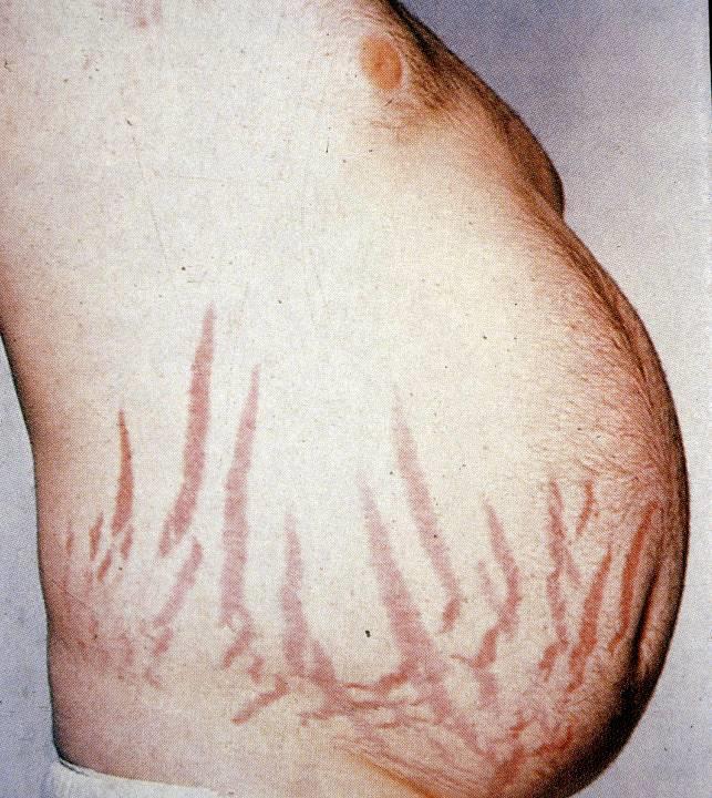 m.