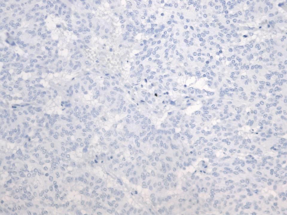 CA 19-9