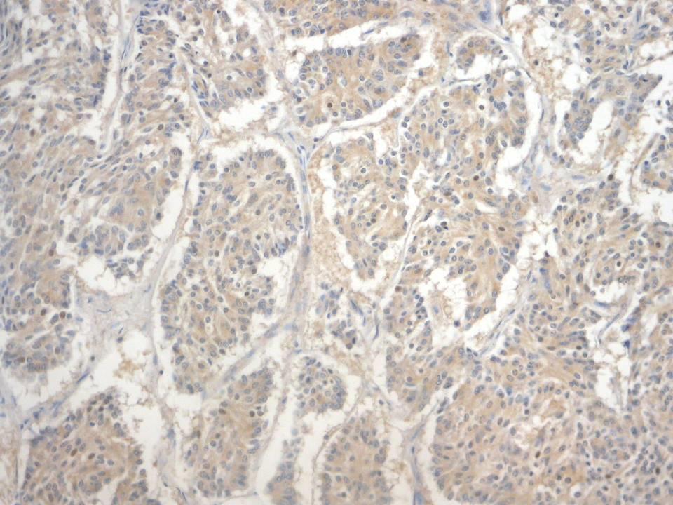 glukagon