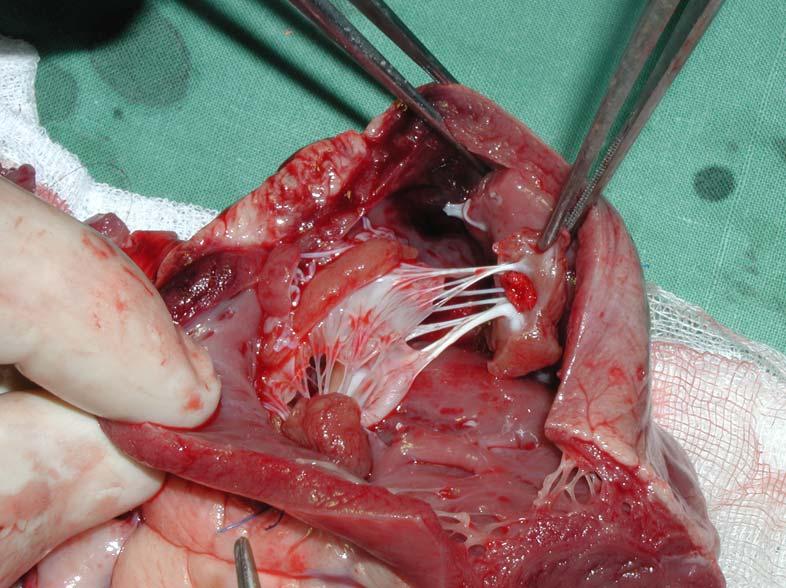Obr. 20: Pohled na implantovanou chlopeň z pravé síně po explantaci srdce.