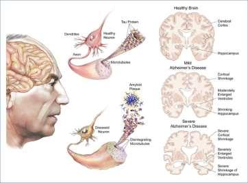 37 37 GABA GABA se vyskytuje téměř výlučně v mozku a proto určena jako neuromediátor relativně brzy lokalizace: lokální okruhy hvězdicovitých buněk v mozkové kůře, Purkyňovy buňky v mozečku,