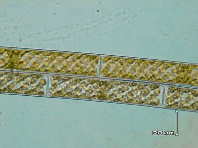 Příloha 15: Spirogyra sp.