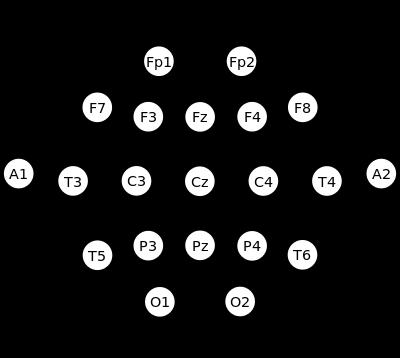 Úvod do elektroencefalografie Měření EEG 2.