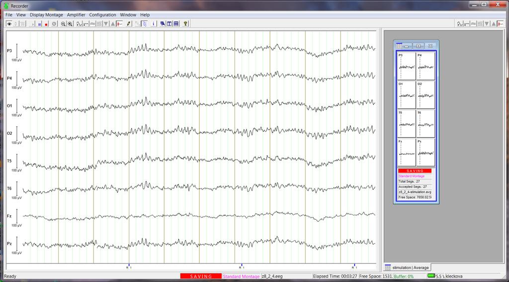 Obrázek 5.5: Nahrávání EEG záznamu v programu Vision Recorder Každý naměřený EEG záznam obsahuje následující 3 soubory: Binární soubor.