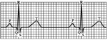 Elektrické biosignály EKG název zdroj elektrody rozsahy