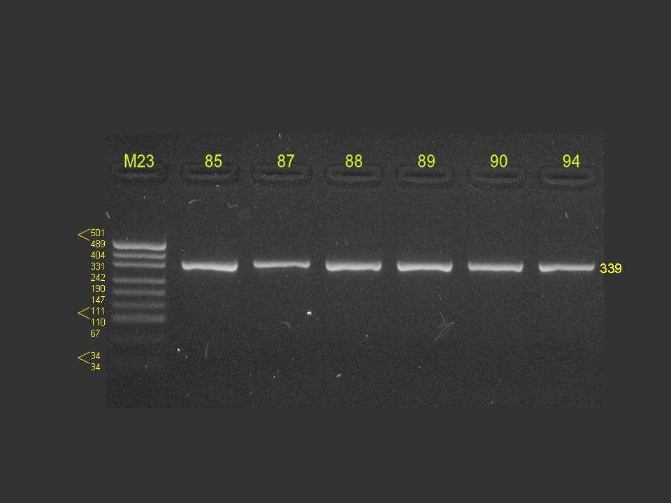 Stanovení polymorfizmu TaqI v genu LPIN1 PCR produkt (316 bp) tvoří po štěpení restrikční endonukleázou TaqI dle genotypu fragmenty následujících velikostí: TT 316 bp (genotyp nebyl v