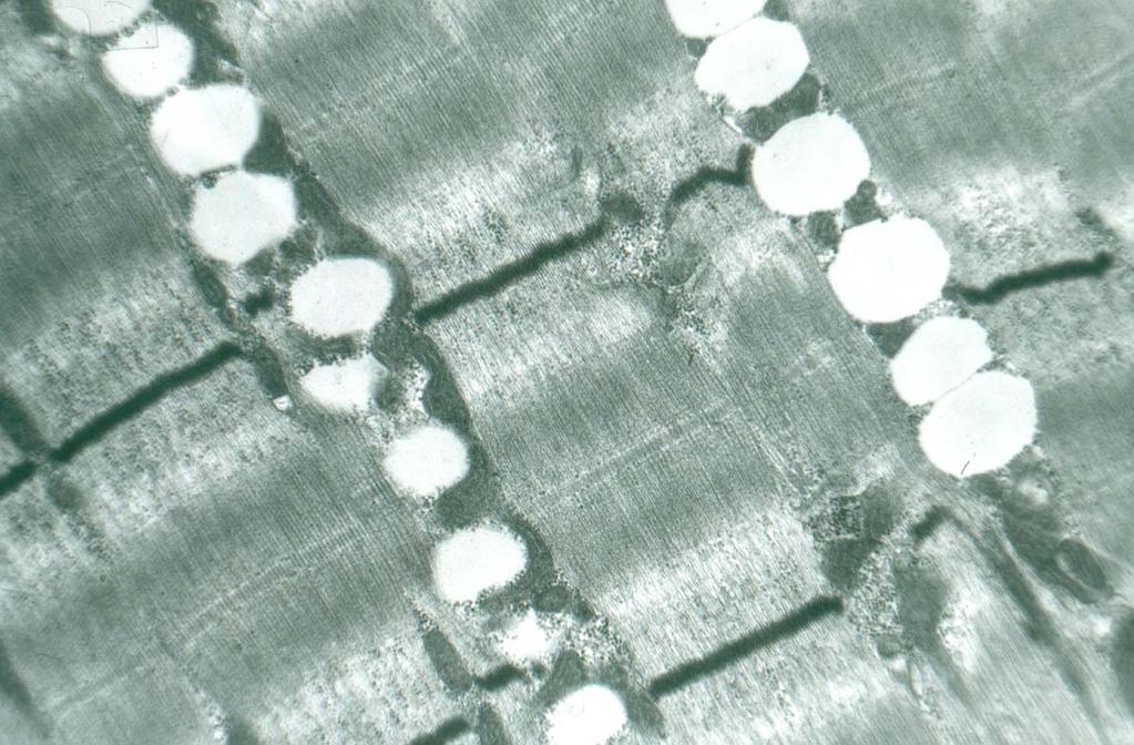 0br.15 Elektronogram kosterního svalu steatosa