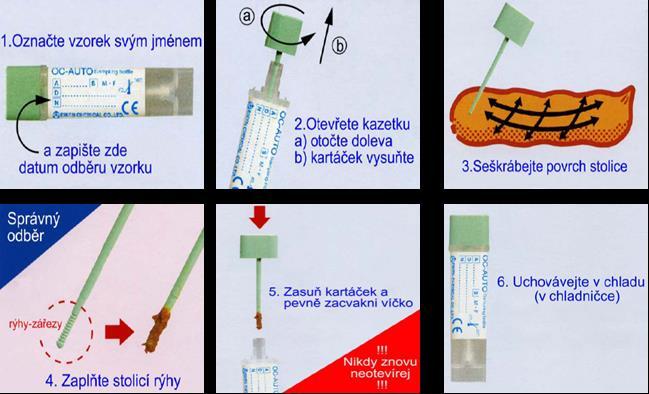 G-03 Test na přítomnost krve ve stolici POKYNY PRO PACIENTY Vážená paní, vážený pane, Váš ošetřující lékař Vám doporučil vyšetření, které může prokázat přítomnost krve ve stolici.