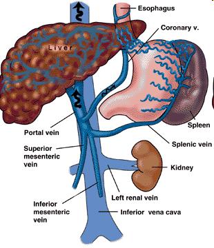 Jícnové varixy dilatace žilních pletení ve stěně jícnu v důsledku zvýšení tlaku ve v. portae jaterní cirhóza trombóza v.