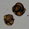 Urocystis anemones (trvalý preparát) Listová sněť na rodu Anemone.