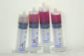 Co mohou skrývat dýchací cesty u granulomatózy s polyangiitidou (Wegenerovy granulomatózy) s postižením ledvin Obr. č.
