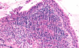 citlivostí antibiotická léčba Augmentin 1 g 1-0-1 po dobu 14 dnů. Obr.