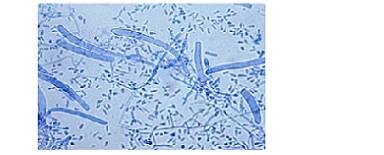Příloha 3 Dermatofyty mikroskopický obraz Obr.