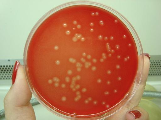 Infekce viridujícími streptokoky Streptococcus agalaciae Gram-pozitivní, β-hemolytický kok Narůstá v řetízkovitém seskupení Na svém povrchu nese