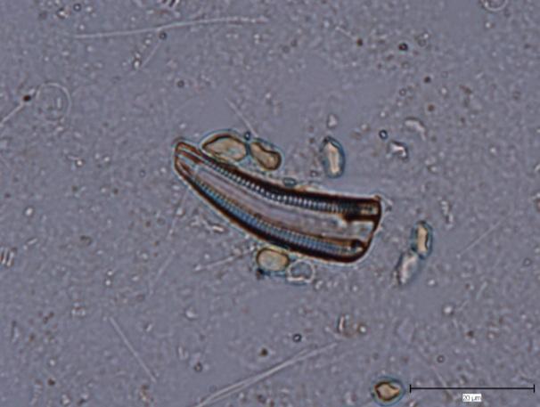 A: Cocconeis pediculus EHRE.