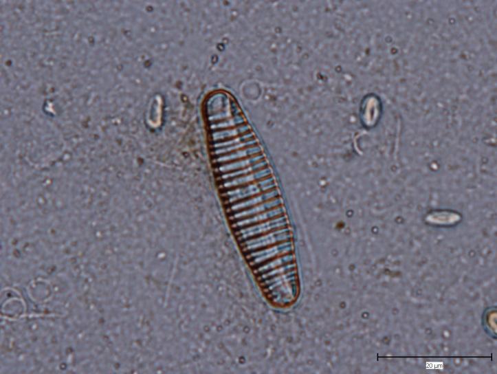 abbreviata (AGAR.