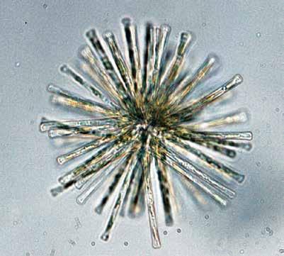 Obr. 3. Asterionella formosa další typický zástupce fytoplanktonu po nápravných opatřeních v Brněnské přehradě (fotografie: R. Geriš) Fig. 3. Asterionella formosa another typical representant of phytoplankton in the Brno Dam after corrective actions (photo: R.