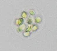 Micractinium v potoce také