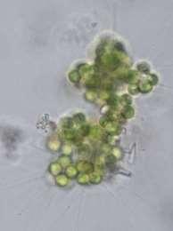 rybník Eudorina Micractinium