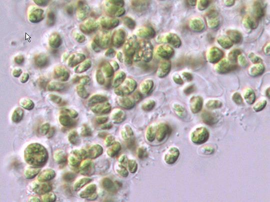 Fermentace indukovaná Chlorococcum minutum Chlamydomonas reinhardtii Chlorella pyrenoidosa (vulgaris nebo sorokiniana) Chlorococcum minutum experimentálně pěstovány v