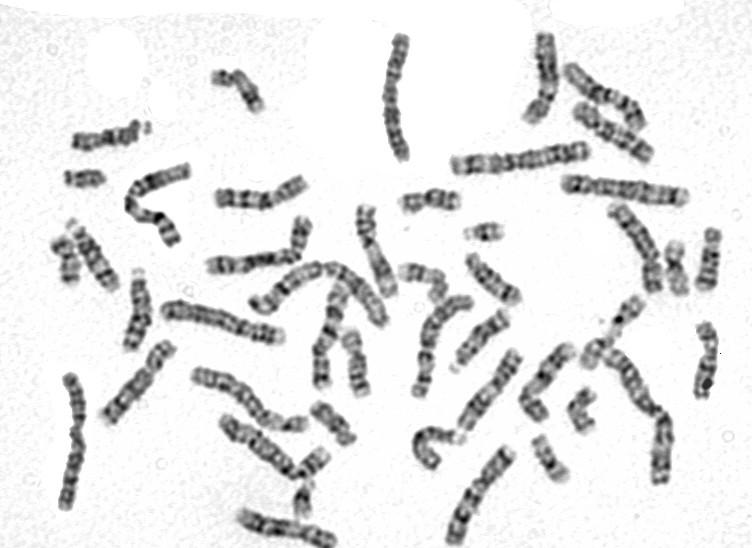 Typy vrozených chromosomových aberací Numerické