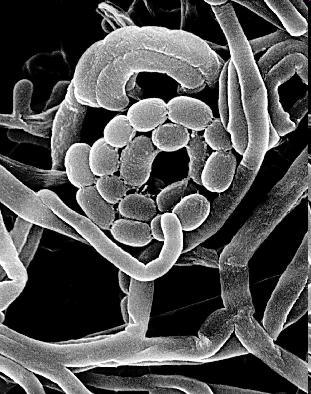 Streptomyces Grampozitivní vláknité bakterie. Je aerobní, saprofytické.