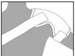 5001 96 B 4 x 800 gauss MagnetBandage