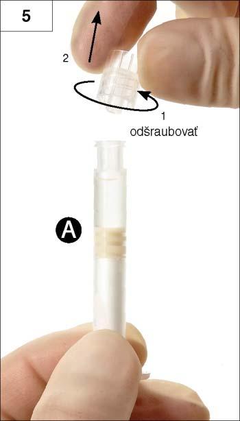 priesvitné viečko (obr. 5).
