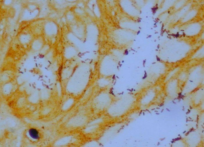 3.2.2 Laboratorní diagnostika