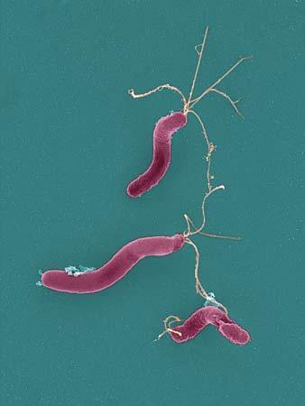 pylori produkovat ureázu a štěpením močoviny za vzniku amoniaku zvyšovat ph, zajišťuje bakterii rezistenci proti kyselému prostředí v ţaludku (1).