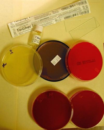 flocked swab, případně cytobrush, transport na sucho Vyšetření moče kontejner Médium