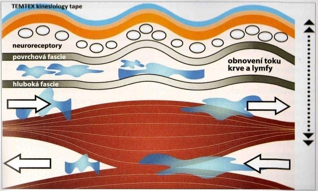 (Kobrová, Válka, 2012) Obrázek 3 Tkáně před aplikací kinesiotapu Zdroj: Kobrová, Válka, 2012 Obrázek 4