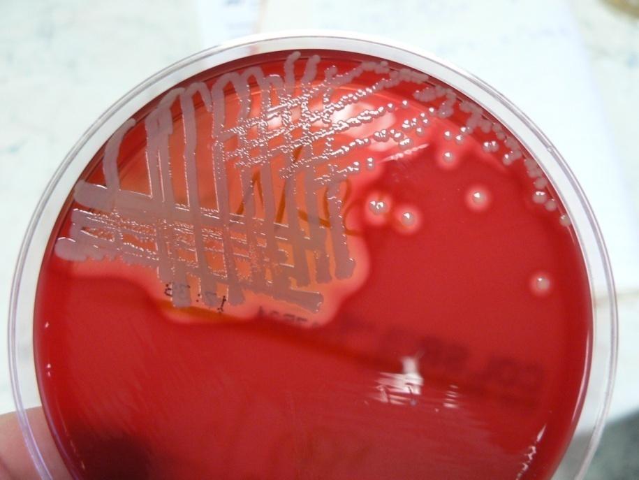 Příloha 4: Staphylococcus aureus - růst na